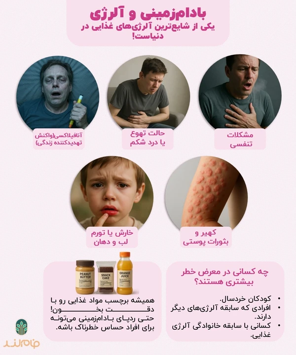 بادام_زمینی و آلرژی فام لند