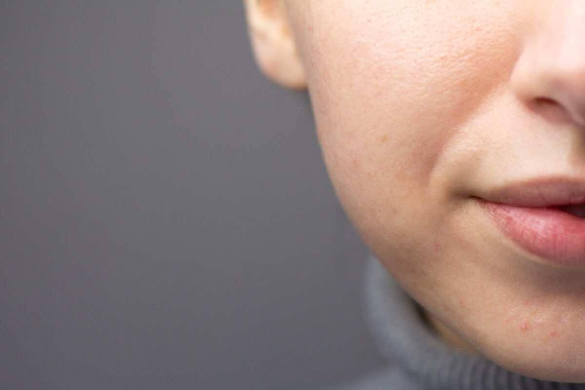 فواید بادام زمینی برای پوست